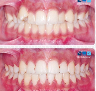 دکتر برهمن سبزواری