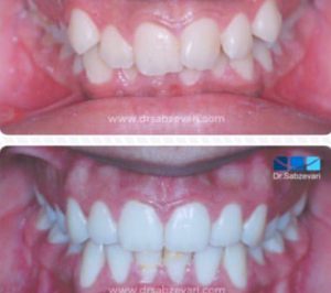 دکتر برهمن سبزواری