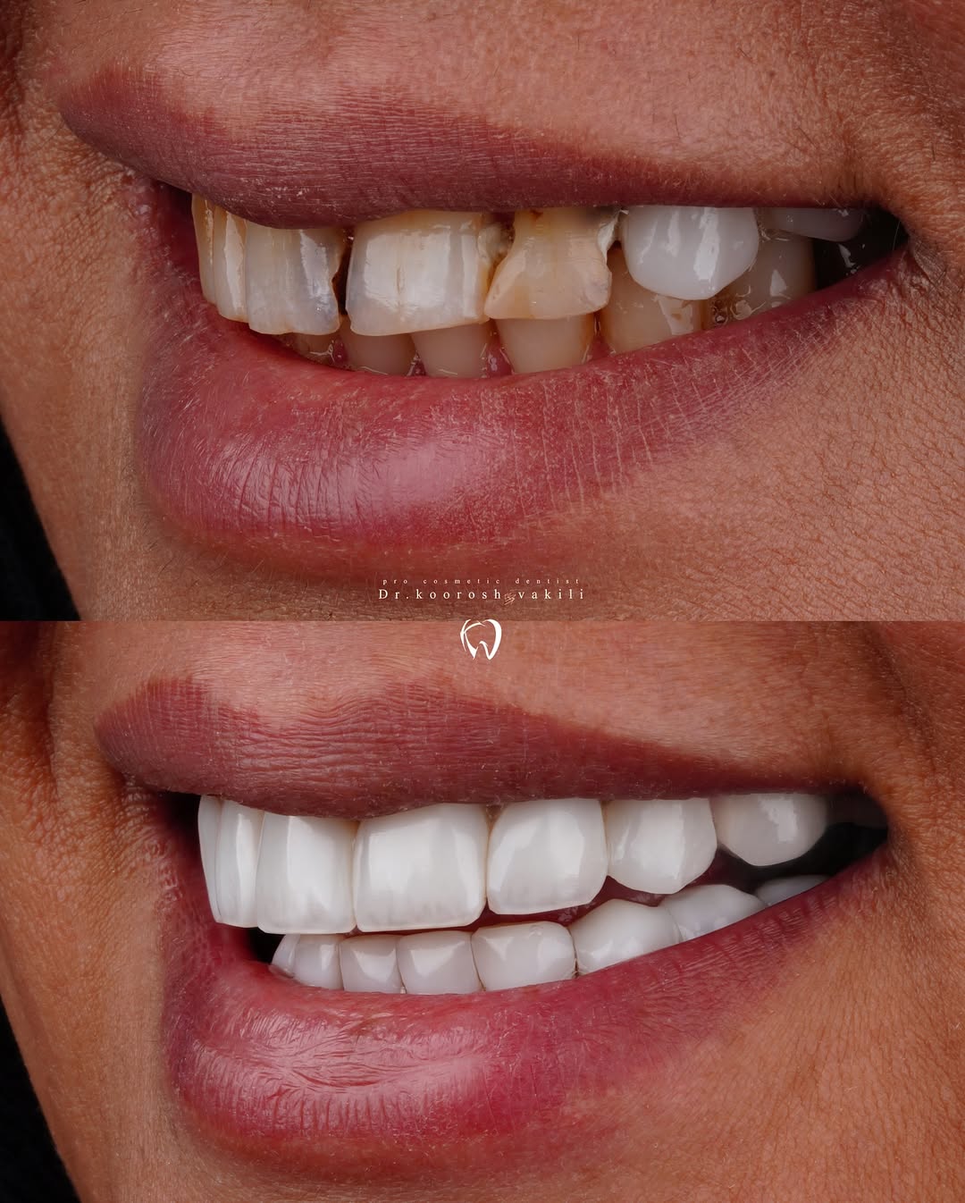 دکتر کوروش وکیلی